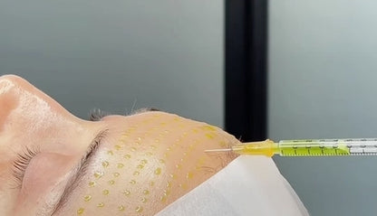 Formation en ligne | Peeling Cl3